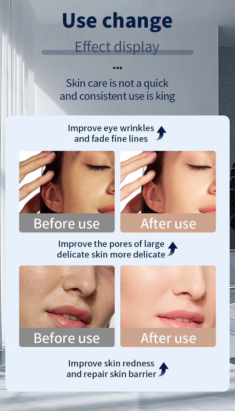 Wrinkles, Skin Rejuvenation, Home Use