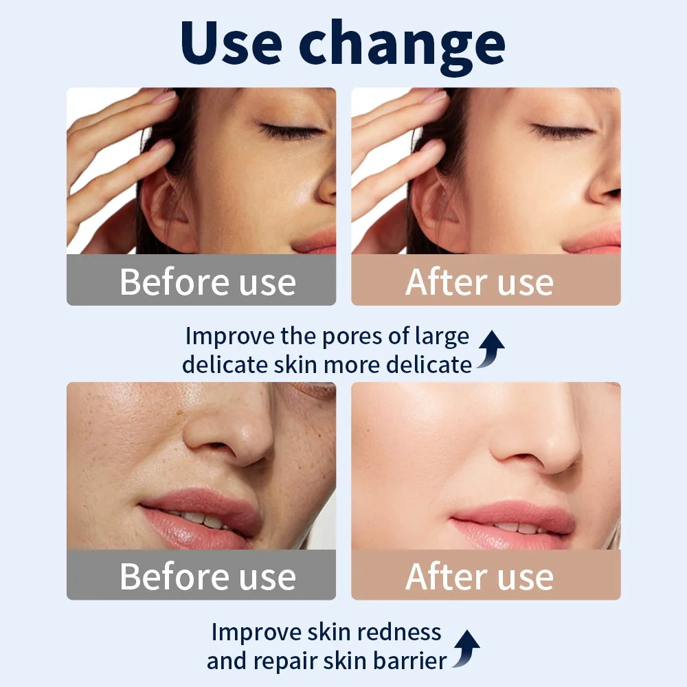 Wrinkles, Skin Rejuvenation, Home Use
