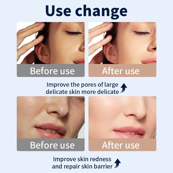 Wrinkles, Skin Rejuvenation, Home Use