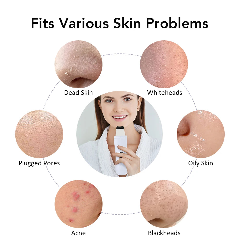 Ultrasonic Cleaner Peeling Skin Care Device