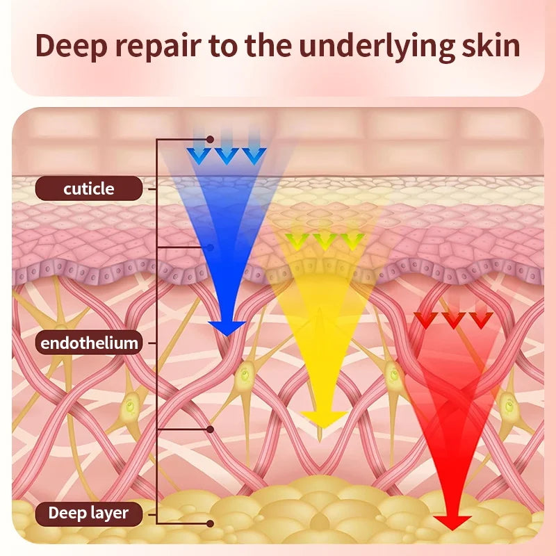 Wrinkles, Skin Rejuvenation, Home Use