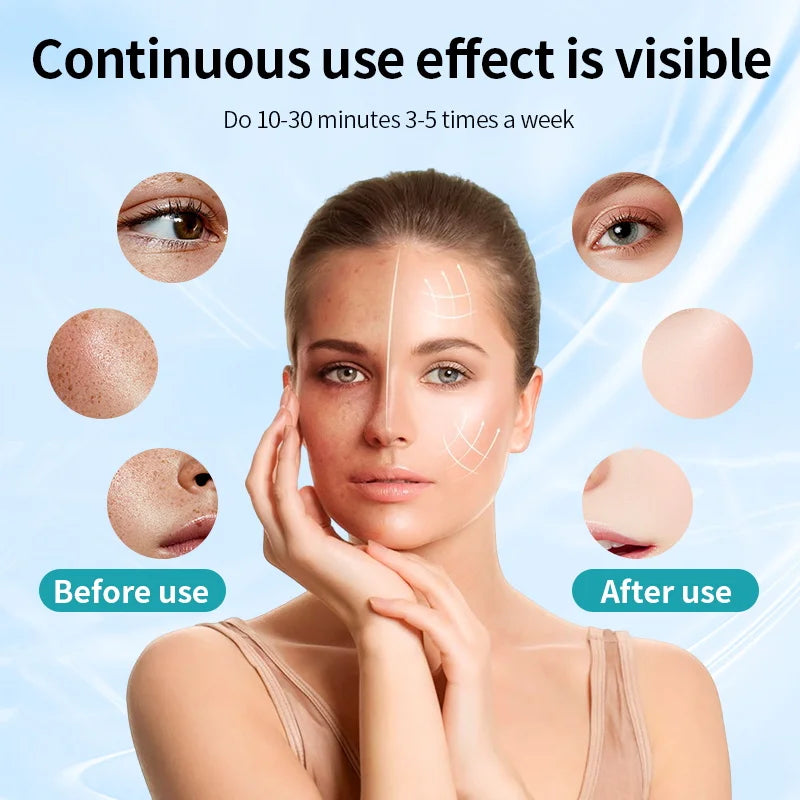 Wrinkles, Skin Rejuvenation, Home Use
