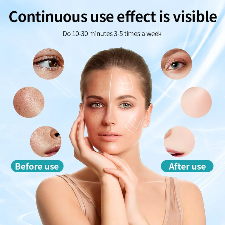 Wrinkles, Skin Rejuvenation, Home Use
